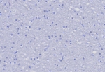 Negative control: IHC testing of FFPE human brain tissue with PSGL1 antibody (clone PSGL1/8192R) at 2ug/ml. HIER: boil tissue sections in pH 9 10mM Tris with 1mM EDTA for 20 min and allow to cool before testing.