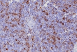 IHC staining of FFPE human tonsil tissue with PSGL-1 antibody (clone PSGL1/8192R). HIER: boil tissue sections in pH 9 10mM Tris with 1mM EDTA for 20 min and allow to cool before testing.