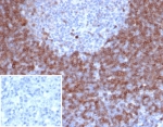 IHC staining of FFPE human lymph node tissue with recombinant IgD antibody (clone IGHD/6818R). Inset: PBS used in place of primary Ab (secondary Ab negative control). HIER: boil tissue sections in pH 9 10mM Tris with 1mM EDTA for 20 min and allow to cool before testing.