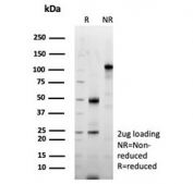 SDS-PAGE analysis of purified, BSA-free recombinant Periostin antibody (clone POSTN/8523R) as confirmation of integrity and purity.