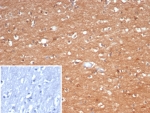 IHC staining of FFPE human brain tissue with Creatine kinase B antibody (clone CKBB/6566). Inset: PBS used in place of primary Ab (secondary Ab negative control). HIER: boil tissue sections in pH 9 10mM Tris with 1mM EDTA for 20 min and allow to cool before testing.