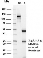 SDS-PAGE analysis of purified, BSA-free Creatine kinase B antibody (clone CKBB/6566) as confirmation of integrity and purity.