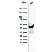 Western blot testing of human Y79 cell lysate with Creatine kinase B antibody (clone CKBB/6567). Predicted molecular weight ~43 kDa.