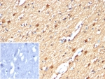IHC staining of FFPE human brain tissue with Creatine kinase B antibody (clone CKBB/6567). Inset: PBS used in place of primary Ab (secondary Ab negative control). HIER: boil tissue sections in pH 9 10mM Tris with 1mM EDTA for 20 min and allow to cool before testing.