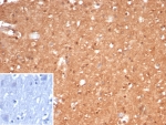 IHC staining of FFPE human brain tissue with Brain Creatine Kinase antibody (clone CKBB/6568). Inset: PBS used in place of primary Ab (secondary Ab negative control). HIER: boil tissue sections in pH 9 10mM Tris with 1mM EDTA for 20 min and allow to cool before testing.