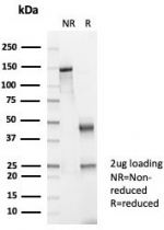 SDS-PAGE analysis of purified, BSA-free Brain Creatine Kinase antibody (clone CKBB/6568) as confirmation of integrity and purity.