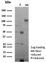 SDS-PAGE analysis of purified, BSA-free Brain Creatine Kinase antibody (clone CKBB/8843R) as confirmation of integrity and purity.