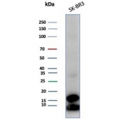 Western blot testing of human SK-BR-3 cell lysate with GCHFR antibody (clone GCHFR/7732). Predicted molecular weight ~12 kDa.