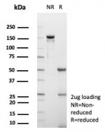 SDS-PAGE analysis of purified, BSA-free GCHFR antibody (clone GCHFR/7732) as confirmation of integrity and purity.