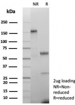 SDS-PAGE analysis of purified, BSA-free Creatine phosphokinase BB antibody (clone CKBB/8609R) as confirmation of integrity and purity.