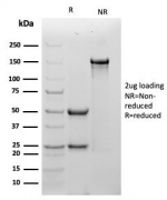 SDS-PAGE analysis of purified, BSA-free Tropomyosin antibody (clone TPM1/4510) as confirmation of integrity and purity.