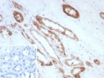 IHC staining of FFPE human kidney tissue with Creatine kinase B antibody (clone CKBB/8840R). Inset: PBS used in place of primary Ab (secondary Ab negative control). HIER: boil tissue sections in pH 9 10mM Tris with 1mM EDTA for 20 min and allow to cool before testing.