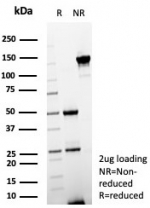 SDS-PAGE analysis of purified, BSA-free Estrogen Inducible Protein pS2 antibody (clone TFF1/7891) as confirmation of integrity and purity.