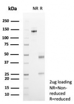 SDS-PAGE analysis of purified, BSA-free Estrogen Inducible Protein pS2 antibody (clone TF/7768) as confirmation of integrity and purity.