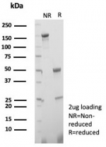 SDS-PAGE analysis of purified, BSA-free Estrogen Inducible Protein pS2 antibody (clone TF/7770) as confirmation of integrity and purity.