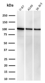 Western blot testing of human U-87, A549 and SK-BR-3 cell lysate with recombinant MVP antibody (clone r1032). Expected molecular weight: 104-110 kDa.