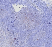 IHC staining of FFPE human tonsil tissue with recombinant BCMA antibody (clone CD269/7986R). HIER: boil tissue sections in pH 9 10mM Tris with 1mM EDTA for 20 min and allow to cool before testing.