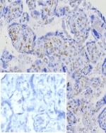 IHC staining of FFPE human placental tissue with BCMA antibody (clone CD269/8125R). Inset: PBS used in place of primary Ab (secondary Ab negative control). HIER: boil tissue sections in pH 9 10mM Tris with 1mM EDTA for 20 min and allow to cool before testing.