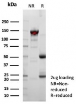 SDS-PAGE analysis of purified, BSA-free recombinant MSLN antibody (clone rMSLN/8764) as confirmation of integrity and purity.