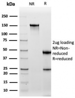 SDS-PAGE analysis of purified, BSA-free Cadherin 16 antibody (clone CDH16/2449) as confirmation of integrity and purity.