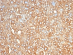 IHC staining of FFPE human liver tissue with HP antibody (clone HP/3831). HIER: boil tissue sections in pH 9 10mM Tris with 1mM EDTA for 20 min and allow to cool before testing.
