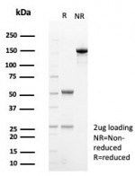 SDS-PAGE analysis of purified, BSA-free HP antibody (clone HP/3831) as confirmation of integrity and purity.