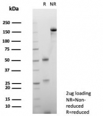 SDS-PAGE analysis of purified, BSA-free Haptoglobin antibody (clone HP/4813) as confirmation of integrity and purity.