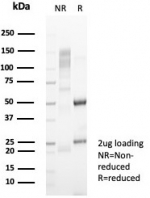 SDS-PAGE analysis of purified, BSA-free Haptoglobin antibody (clone HP/4815) as confirmation of integrity and purity.