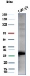 Western blot testing of human Daudi cell lysate with Haptoglobin antibody (clone HP/3838). Predicted molecular weight: 35-40 kDa (beta chain), 45-50 kDa (alpha + beta chain).