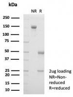 SDS-PAGE analysis of purified, BSA-free Haptoglobin antibody (clone HP/3838) as confirmation of integrity and purity.