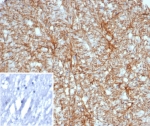 IHC staining of FFPE human brain tissue with Glial Fibrillary Acidic Protein antibody (clone GFAP/6876). Inset: PBS used in place of primary Ab (secondary Ab negative control). HIER: boil tissue sections in pH 9 10mM Tris with 1mM EDTA for 20 min and allow to cool before testing.