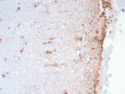 IHC staining of FFPE dog brain with GFAP antibody (clone GFAP/6881). HIER: boil tissue sections in pH 9 10mM Tris with 1mM EDTA for 20 min and allow to cool before testing.