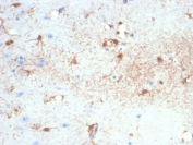 IHC staining of FFPE horse brain with GFAP antibody (clone GFAP/6881). HIER: boil tissue sections in pH 9 10mM Tris with 1mM EDTA for 20 min and allow to cool before testing.