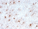 IHC staining of FFPE human brain tissue with GFAP antibody (clone GFAP/6882). HIER: boil tissue sections in pH 9 10mM Tris with 1mM EDTA for 20 min and allow to cool before testing.