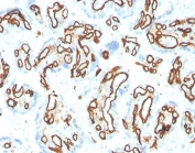 IHC staining of FFPE human placental tissue with CD31 antibody (clone PECAM1/3533). HIER: boil tissue sections in pH 9 10mM Tris with 1mM EDTA for 20 min and allow to cool before testing.