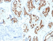 IHC staining of FFPE human placental tissue with CD31 antibody (clone PECAM1/3533). Inset: PBS used in place of primary Ab (secondary Ab negative control). HIER: boil tissue sections in pH 9 10mM Tris with 1mM EDTA for 20 min and allow to cool before testing.