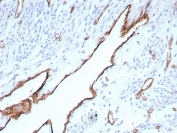 IHC staining of FFPE human placental tissue with CD31 antibody (clone rPECAM1/8832). HIER: boil tissue sections in pH 9 10mM Tris with 1mM EDTA for 20 min and allow to cool before testing.