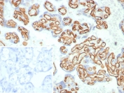 IHC staining of FFPE human placental tissue with CD31 antibody (clone C31/8359R). Inset: PBS used in place of primary Ab (secondary Ab negative control). HIER: boil tissue sections in pH 9 10mM Tris with 1mM EDTA for 20 min and allow to cool before testing.