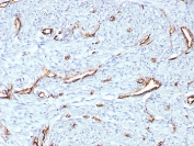 IHC staining of FFPE human uterus tissue with CD31 antibody (clone C31/8359R). HIER: boil tissue sections in pH 9 10mM Tris with 1mM EDTA for 20 min and allow to cool before testing.