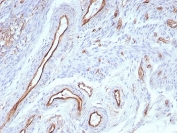 IHC staining of FFPE human uterus tissue with CD31 antibody (clone rPECAM1/8830). HIER: boil tissue sections in pH 9 10mM Tris with 1mM EDTA for 20 min and allow to cool before testing.