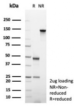 SDS-PAGE analysis of purified, BSA-free CD31 antibody (clone C31/8242R) as confirmation of integrity and purity.