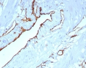 IHC staining of FFPE human uterus tissue with CD31 antibody (clone C31/8242R). HIER: boil tissue sections in pH 9 10mM Tris with 1mM EDTA for 20 min and allow to cool before testing.