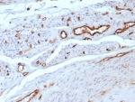 IHC staining of FFPE human uterus tissue with CD31 antibody (clone C31/8592R). HIER: boil tissue sections in pH 9 10mM Tris with 1mM EDTA for 20 min and allow to cool before testing.