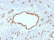 IHC staining of FFPE human uterus tissue with PECAM-1 antibody (clone C31/8593R). HIER: boil tissue sections in pH 9 10mM Tris with 1mM EDTA for 20 min and allow to cool before testing.