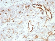 IHC staining of FFPE human uterus tissue with PECAM-1 antibody (clone C31/8828R). HIER: boil tissue sections in pH 9 10mM Tris with 1mM EDTA for 20 min and allow to cool before testing.