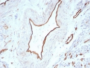 IHC staining of FFPE human uterus tissue with PECAM-1 antibody (clone C31/8831R). HIER: boil tissue sections in pH 9 10mM Tris with 1mM EDTA for 20 min and allow to cool before testing.