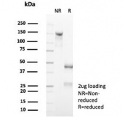 SDS-PAGE analysis of purified, BSA-free CD7 antibody (clone rCD7/6972) as confirmation of integrity and purity.