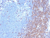 IHC staining of FFPE human lymph node tissue with CD7 antibody (clone rCD7/6972). HIER: boil tissue sections in pH 9 10mM Tris with 1mM EDTA for 20 min and allow to cool before testing.