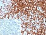 IHC staining of FFPE human tonsil tissue with recombinant CD7 antibody (clone CD7/8496R). Inset: PBS used in place of primary Ab (secondary Ab negative control). HIER: boil tissue sections in pH 9 10mM Tris with 1mM EDTA for 20 min and allow to cool before testing.