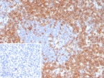 IHC staining of FFPE human tonsil tissue with CD7 antibody (clone CD7/8118R). Inset: PBS used in place of primary Ab (secondary Ab negative control). HIER: boil tissue sections in pH 9 10mM Tris with 1mM EDTA for 20 min and allow to cool before testing.